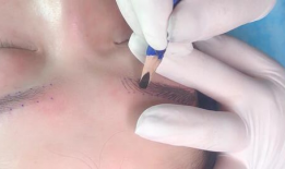 采血针的使用方法视频,轻松掌握采血技巧